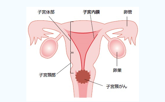 日本宫颈癌医院排名