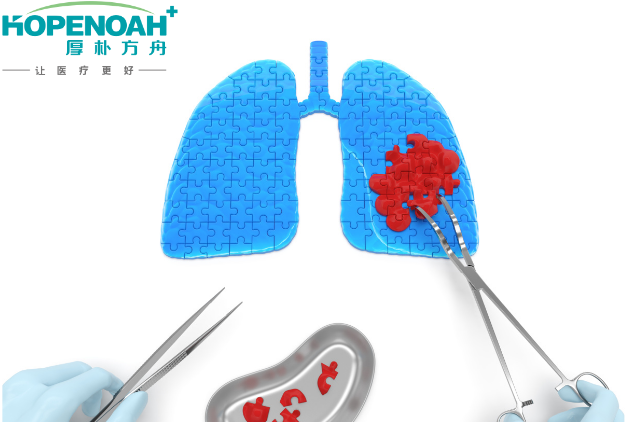 肺癌做手术复发率高吗
