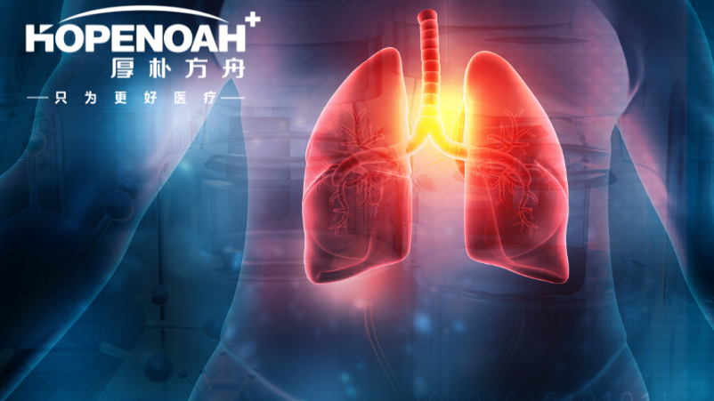 肺癌晚期能活几年，肺癌双免疫治疗后可存活几年