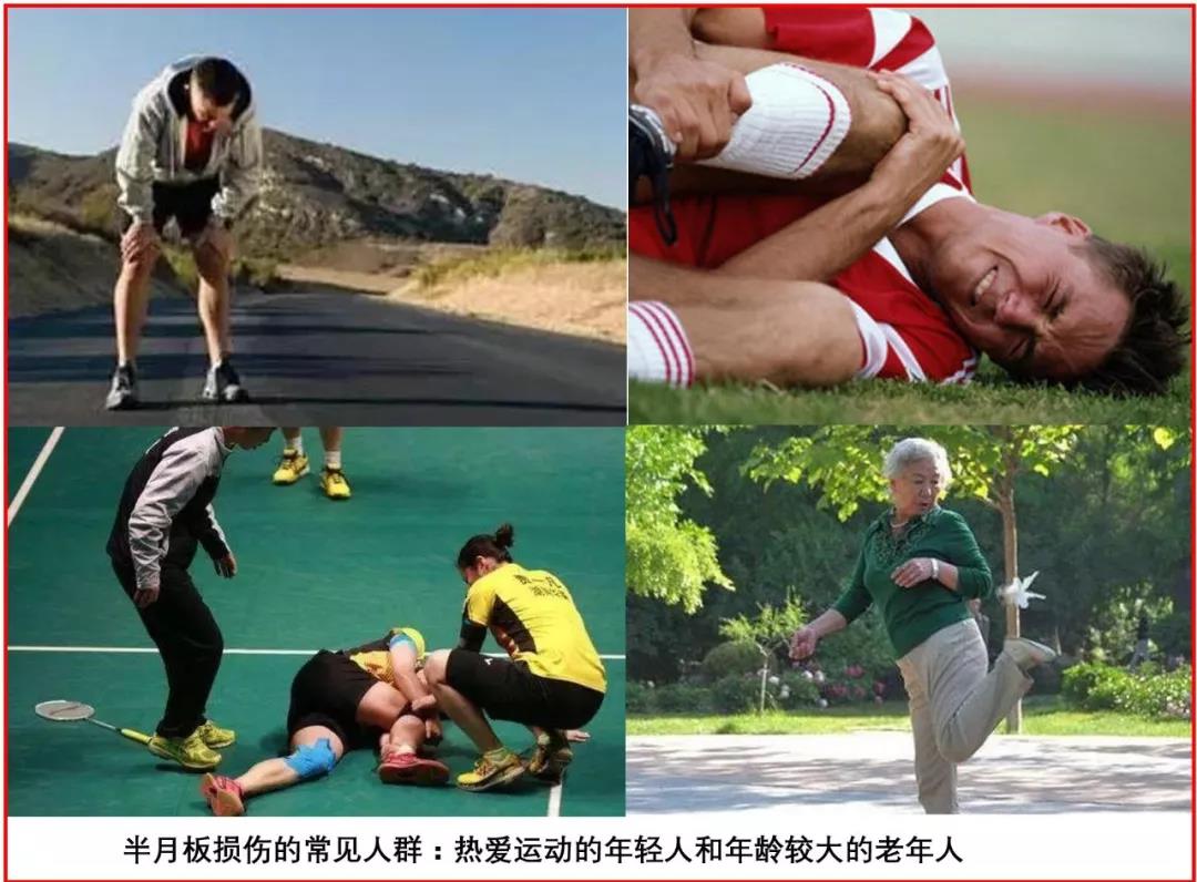 关节炎治疗