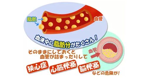日本体检