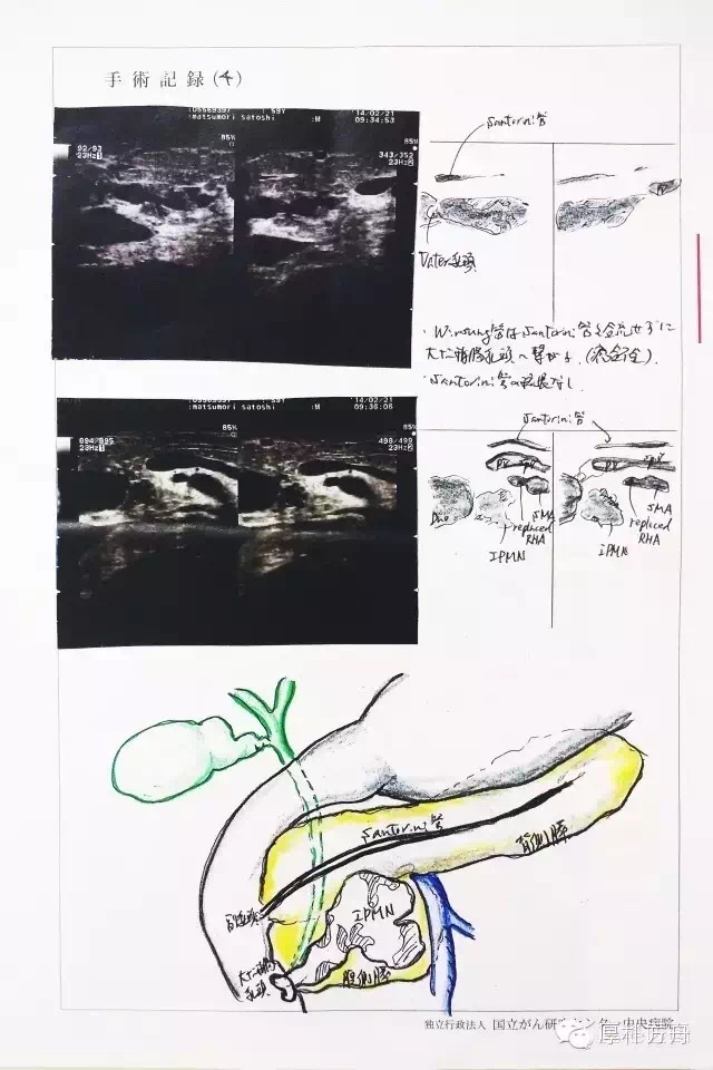 日本手术记录