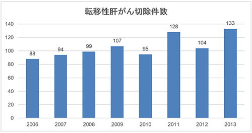 图：转移性<a  data-cke-saved-href='/anlis/jibing2/' href='/anlis/jibing2/'>肝癌</a>切除数