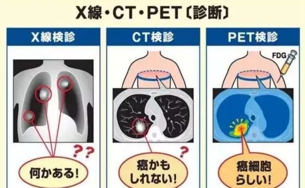赴日体检