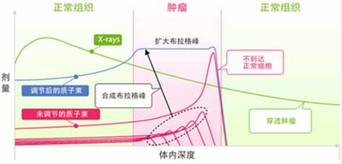 日本质子治疗
