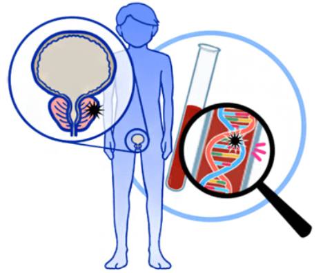 日本理研等对前列腺癌实施大规模DNA解析