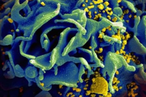 duoCAR-T细胞可有效抵抗HIV