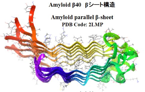 阿尔茨海默氏症出国治疗：日本研究人员发现β-淀粉样蛋白沉积的机理