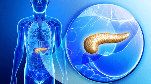 胰腺癌出国治疗：真菌微生物与胰腺导管腺癌的发生具有密切联系！