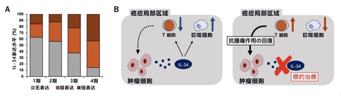 日本新研究指出IL-34与卵巢癌的进展和复发有密切联系！
