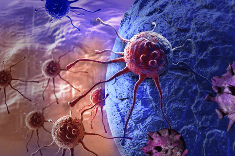肺癌新研究：EGFR阴性进展性非小细胞肺癌临床试验结果已出