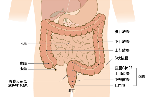 直肠癌