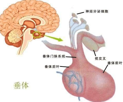 脑垂体瘤治疗方法