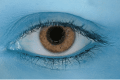 眼部肿瘤治疗技术,眼睑肿瘤类型,眼睑肿瘤治疗方