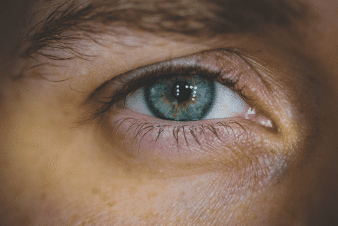 眼睑肿瘤治疗方法
