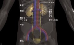 输尿管癌治疗,输尿管癌治疗方法,输尿管癌