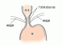 返流性食管炎治疗,返流性食管炎药物治疗,返流性