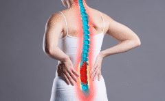 脊柱融合手术,骨质疏松症,成人脊柱畸形