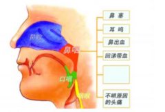 鼻窦癌,鼻窦癌确诊方法,鼻窦癌怎么检查确诊