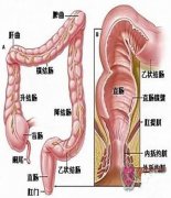 坂本一博，结直肠癌肝肺转移