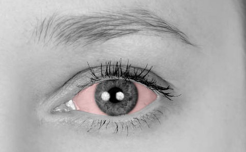 眼脉络膜炎,眼脉络膜炎症状,眼脉络膜炎治疗方法