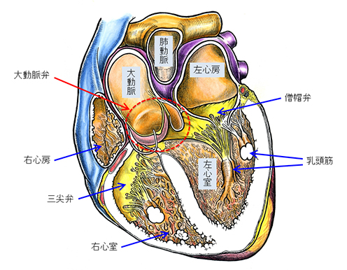 老人心脏瓣膜病治疗