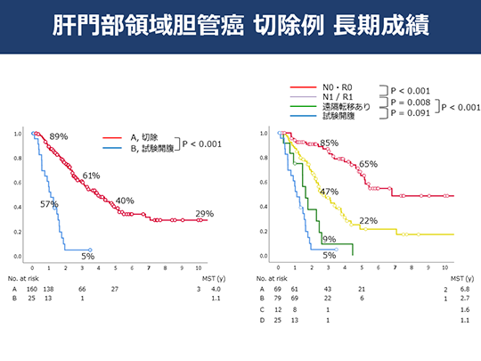 日本癌研有明医院治疗胆管癌