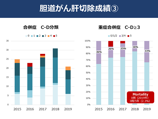 日本癌研有明医院治疗胆管癌