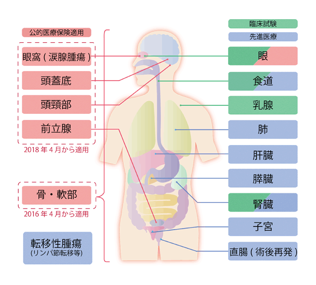 重离子治疗适应症