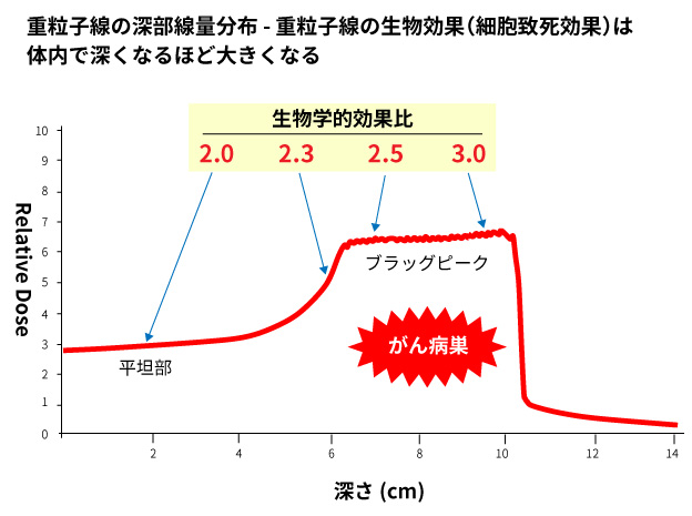 重离子治疗