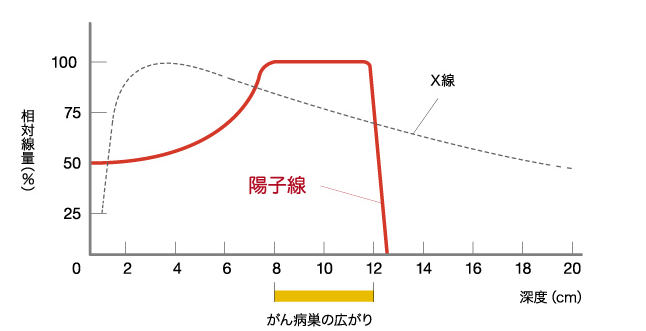 日本质子重离子治疗转移性肺癌