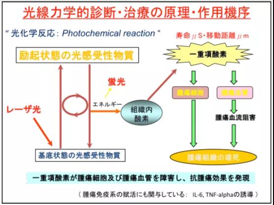 光动力治疗肺癌等癌症