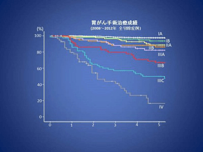 日本胃癌治疗权威医院