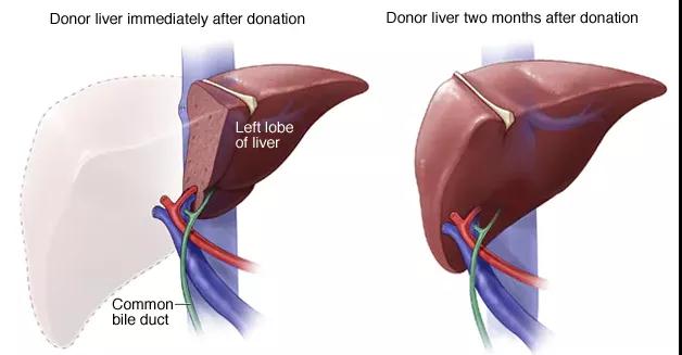 日本肝癌专家川崎诚治讲解肝癌手术应该选肝移植还是肝切除术