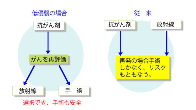 放疗化疗串联方案