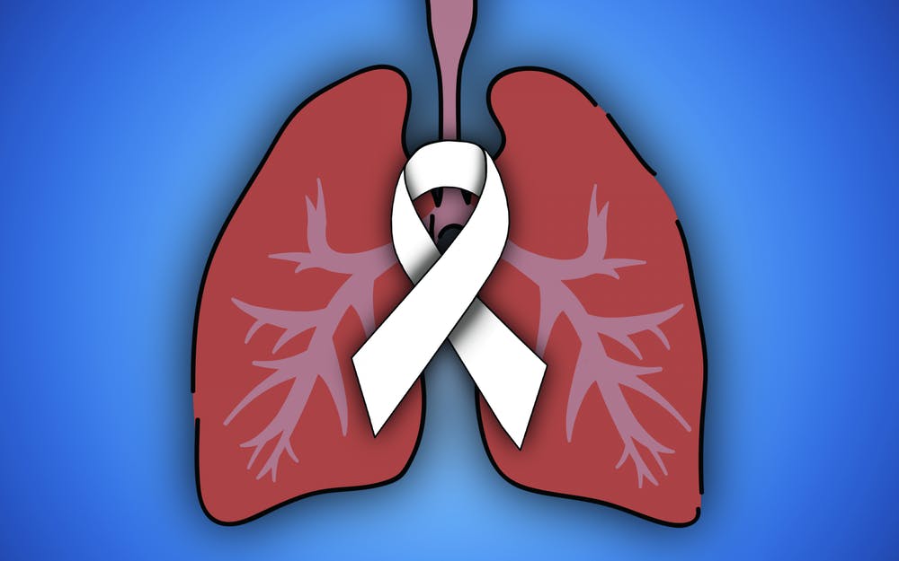 肺癌手术根治