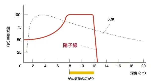 日本骨肉瘤质子治疗