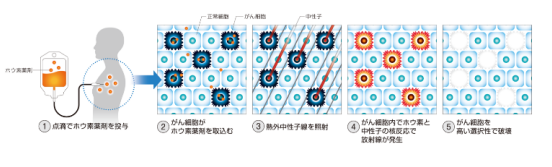 日本头颈部肿瘤治疗