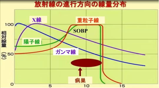 日本筑波大学附属医院质子治疗